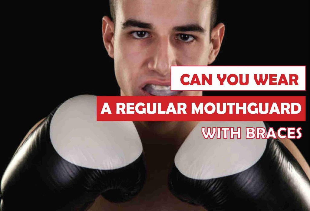 Can You Wear a Regular Mouthguard with Braces